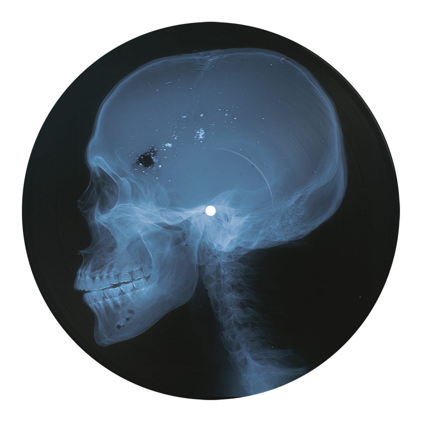 Haftbefehl x Oddworld - Syndrom Stockholm (12" Picture Disc Clear Cover Signiert)